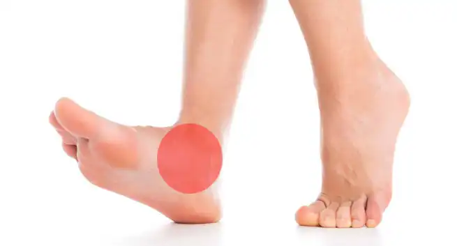 Ankle Pain