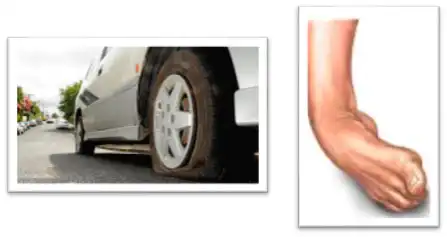 Performance Enhancement