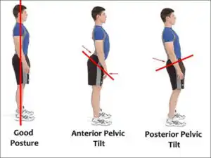 posture